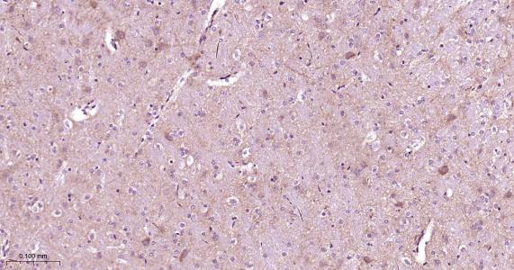 G蛋白结合蛋白RAB10抗体-bs-11257R