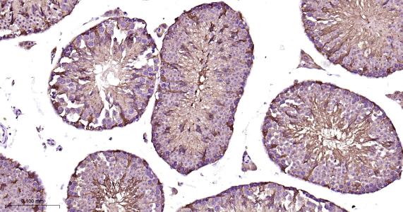 磷脂酰乙醇胺结合蛋白1重组兔单抗-bsm-61243R