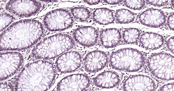 粘液样脂肪肉瘤蛋白FUS1重组兔单抗