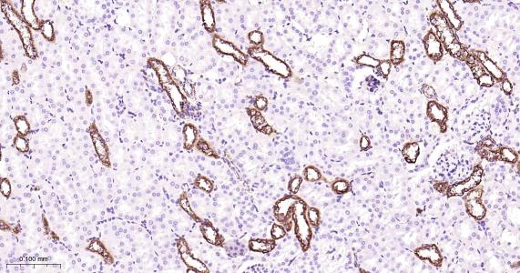 己糖激酶1重组兔单抗
