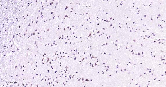 瞬时受体电位离子通道蛋白7重组兔单抗（M亚家族）