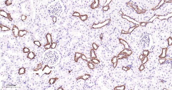 己糖激酶1重组兔单抗