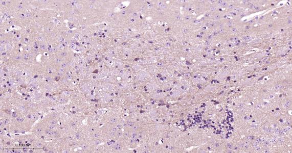 RAB10 Rabbit pAb (一抗) - IHC-P,IHC-F,IF | Bioss