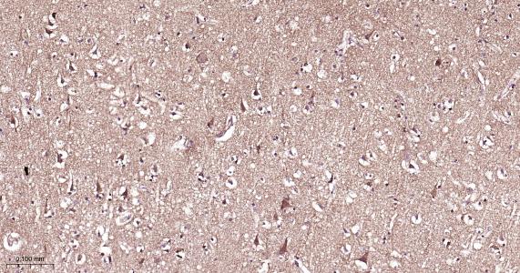 G蛋白结合蛋白RAB10抗体-bs-11257R