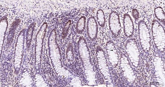 核纤层蛋白B（核内参）单克隆抗体-bsm-33040M