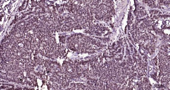 核纤层蛋白B（核内参）单克隆抗体-bsm-33040M