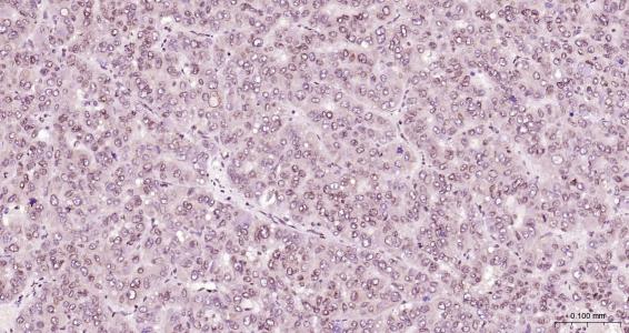 核纤层蛋白B（核内参）单克隆抗体-bsm-33040M