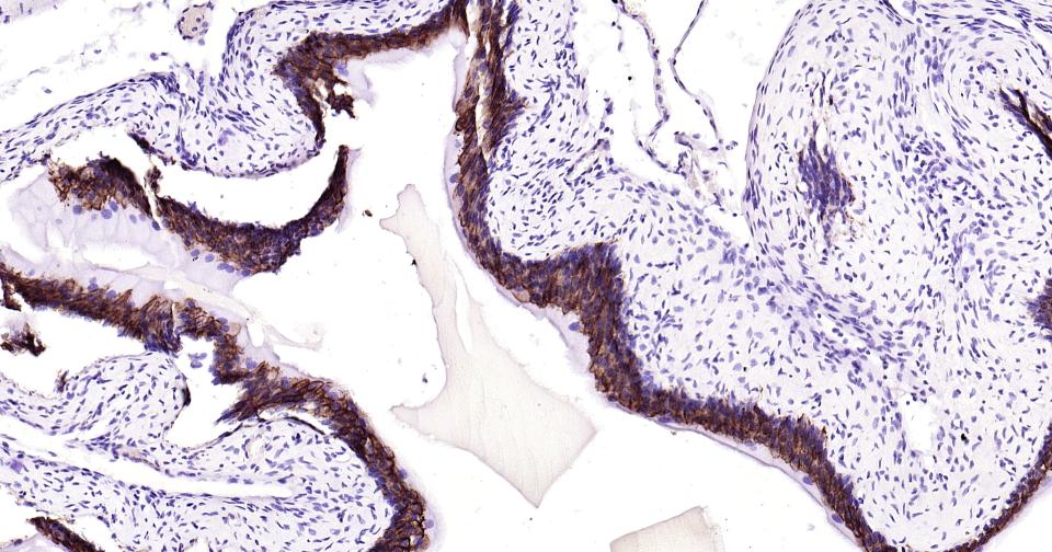 细胞角蛋白19重组兔单抗