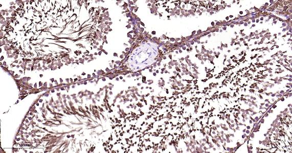 磷脂酰乙醇胺结合蛋白1重组兔单抗-bsm-61243R