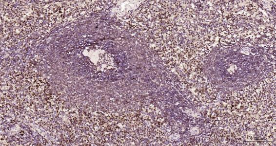 核纤层蛋白B（核内参）单克隆抗体-bsm-33040M