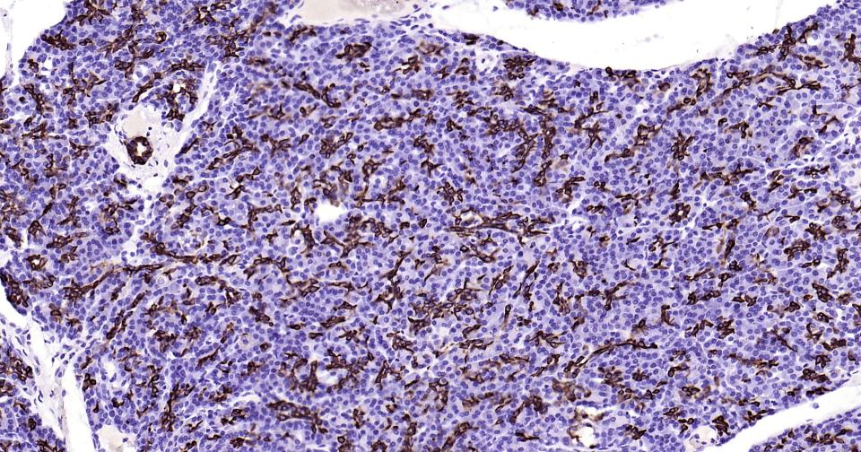 细胞角蛋白19重组兔单抗