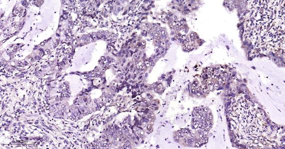 糖原合酶激酶-3β重组兔单抗