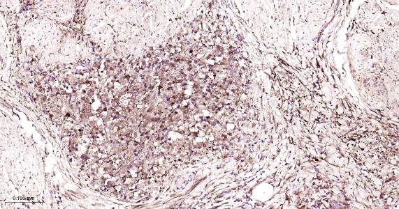 铁蛋白重组兔单抗