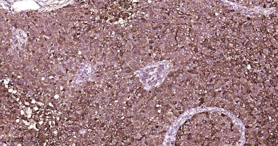 铁蛋白重组兔单抗