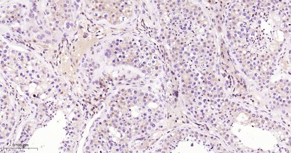 P27/周期素依赖激酶抑制剂重组兔单抗