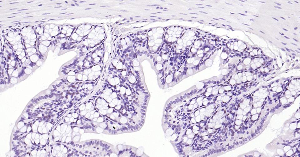 抑癌蛋白EZH2重组兔单抗