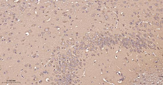 超氧化物歧化酶1重组兔单抗