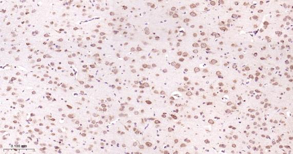 糖原合酶激酶-3β重组兔单抗