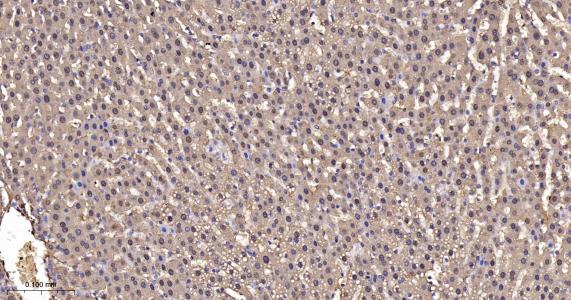 超氧化物歧化酶1重组兔单抗