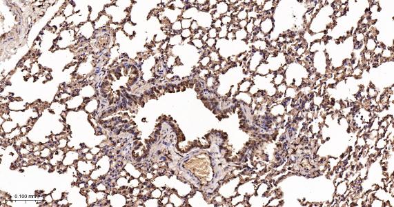 超氧化物歧化酶1重组兔单抗