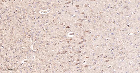 酰基辅酶A合成酶4重组兔单抗