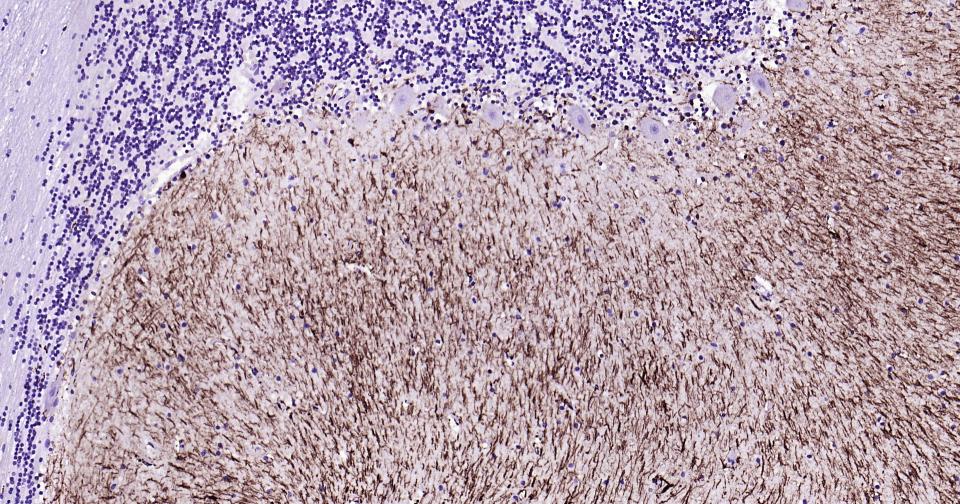胶质纤维酸性蛋白重组兔单抗