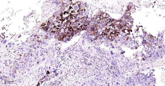 环氧合酶2重组兔单抗