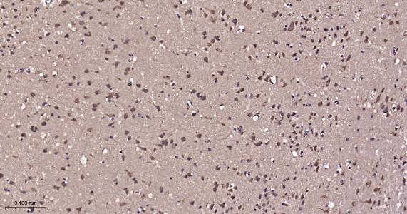 周期素依赖性激酶5重组兔单抗