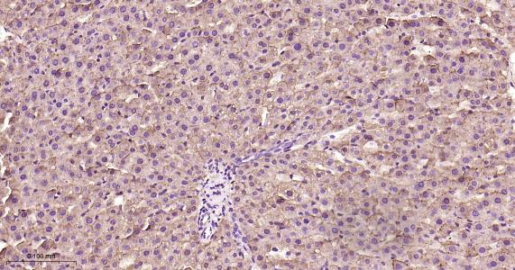 表皮生长因子受体重组兔单抗