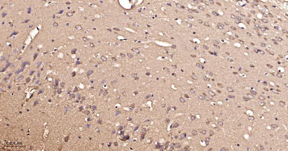 超氧化物歧化酶1重组兔单抗