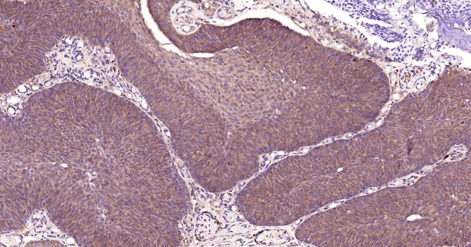 结蛋白重组兔单抗