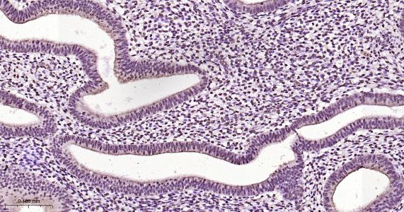 磷酸化雌激素受体ER alpha 重组兔单抗