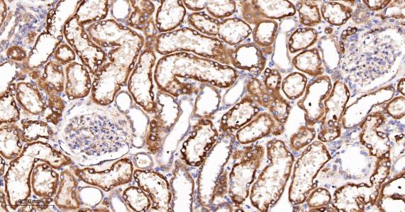 酰基辅酶A合成酶4重组兔单抗