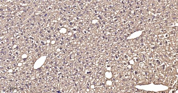 超氧化物歧化酶1重组兔单抗