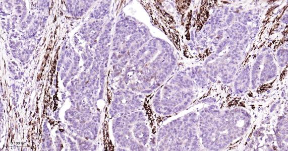 环氧合酶2重组兔单抗