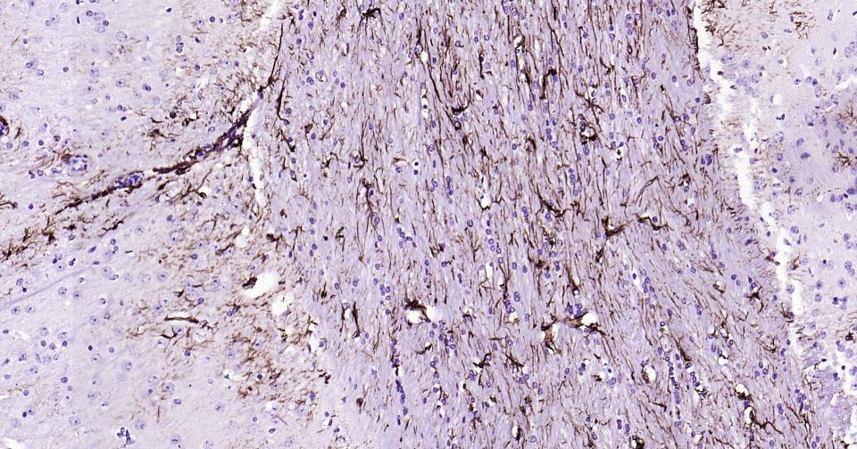胶质纤维酸性蛋白重组兔单抗