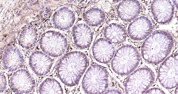 铁蛋白重组兔单抗