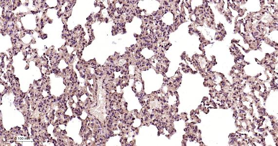 表皮生长因子受体重组兔单抗