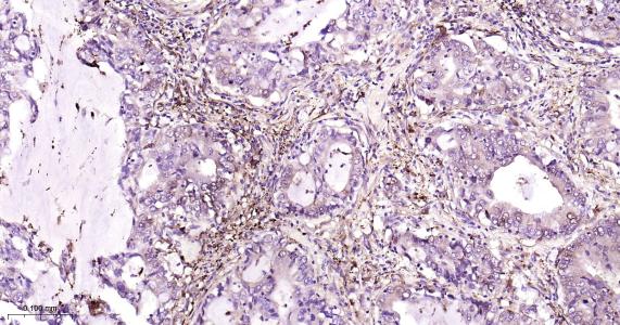 铁蛋白重组兔单抗