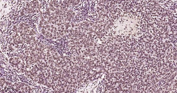 磷酸化雌激素受体ER alpha 重组兔单抗