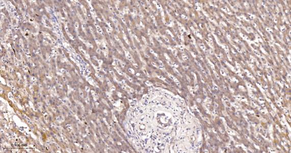 酰基辅酶A合成酶4重组兔单抗