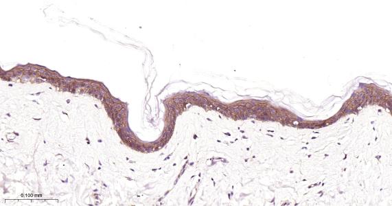 表皮生长因子受体重组兔单抗