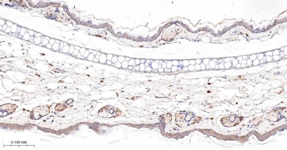 异构核糖核蛋白E2重组兔单抗