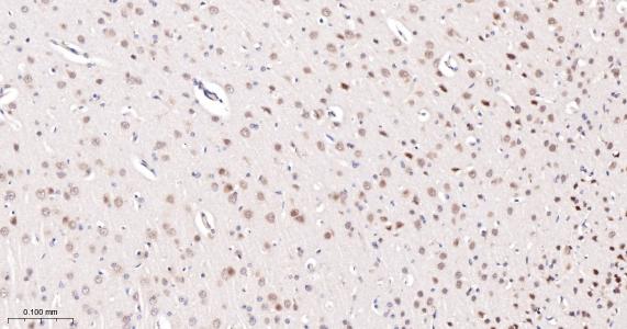 异构核糖核蛋白E2重组兔单抗