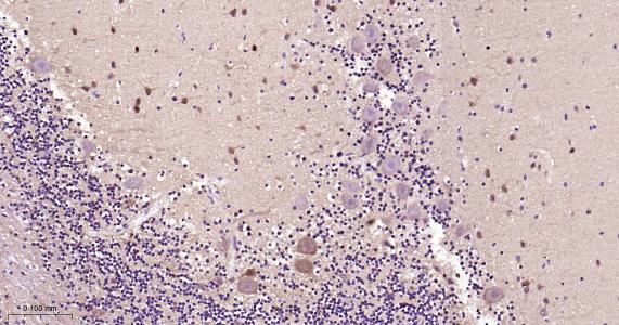 神经生长因子β重组兔单抗