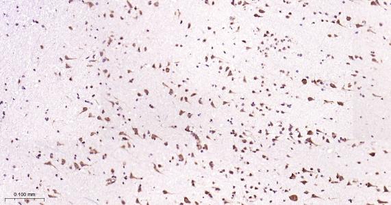 糖原合酶激酶-3β重组兔单抗