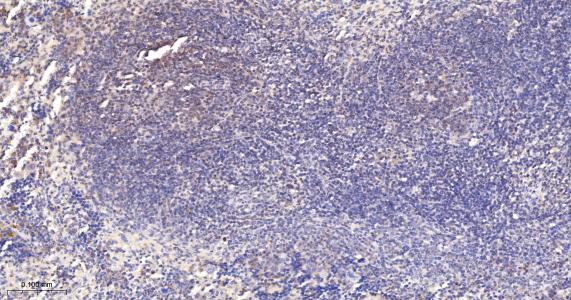 异构核糖核蛋白E2重组兔单抗