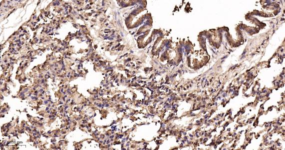 超氧化物歧化酶1重组兔单抗