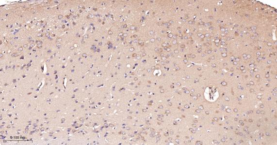 酰基辅酶A合成酶4重组兔单抗