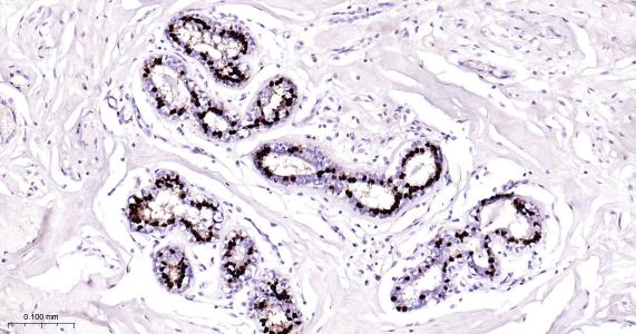 孕激素受体重组兔单克隆抗体